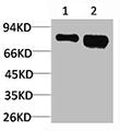 RPS6KB1 Antibody – Figure 1 of 1