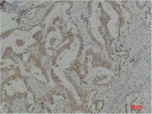 CASP8 Antibody – Figure 1 of 2