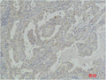 AKT2 Antibody – Figure 1 of 2