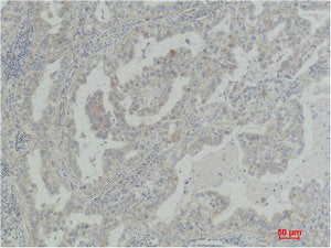 AKT2 Antibody – Figure 1 of 2