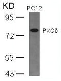 Western blot analysis of extracts from PC12 cells using PKCd(Ab-645) Antibody.