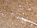 The image on the left is immunohistochemistry of paraffin-embedded Human brain tissue using CSB-PA080695(LGR5 Antibody) at dilution 1/25, on the right is treated with fusion protein. (Original magnification: ×200)