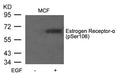 Western blot analysis of extracts from MCF7 cells untreated or treated with EGF using Estrogen Receptor-a(Phospho-Ser106) Antibody.