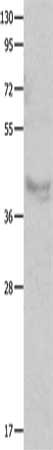 Gel: 10%SDS-PAGE, Lysate: 60 ug, Lane: Human fetal muscle tissue, Primary antibody: CSB-PA080771(CX3CR1 Antibody) at dilution 1/100, Secondary antibody: Goat anti rabbit IgG at 1/8000 dilution, Exposure time: 1 minute