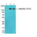 Western blot analysis of extracts from JK cells (Lane 2) and K562 cells (Lane 3), using Met (Ab-1313) antiobdy. The lane on the left is treated with synthesized peptide.