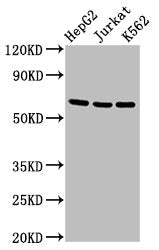 Western Blot
Positive WB detected in: HepG2 whole cell lysate, Jurkat whole cell lysate, K562 whole cell lysate
All lanes: TNFRSF9 antibody at 2.7µg/ml
Secondary
Goat polyclonal to rabbit IgG at 1/50000 dilution
Predicted band size: 28 kDa
Observed band size: 65 kDa