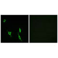 Immunofluorescence analysis of LOVO cells, using DCC antibody.