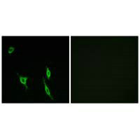Immunofluorescence analysis of LOVO cells, using DCC antibody.