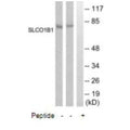 Western blot analysis of extracts from COLO205 and Jurkat cells, using SLCO1B1 antibody.