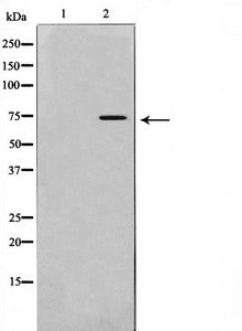 Western blot analysis on HeLa cell lysate using IL-2Rbeta/CD122 antibody,The lane on the left is treated with the antigen-specific peptide.