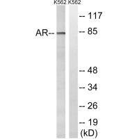 Western blot analysis of extracts from K562 cells, treated with EGF (200ng/ml, 5mins), using Androgen Receptor (Ab-363) antibody.