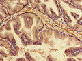 Immunohistochemistry of paraffin-embedded human prostate tissue using CSB-PA08229A0Rb at dilution of 1:100