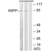 Western blot analysis of extracts from COS-7 cells and A549 cells, using K6PP antibody.