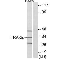 Western blot analysis of extracts from HUVEC cells, using TRA-2α antibody.