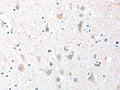 The image on the left is immunohistochemistry of paraffin-embedded Human brain tissue using CSB-PA083230(ADAM20 Antibody) at dilution 1/30, on the right is treated with fusion protein. (Original magnification: ×200)