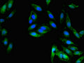 Immunofluorescent analysis of Hela cells using CSB-PA08329A0Rb at dilution of 1:100 and Alexa Fluor 488-congugated AffiniPure Goat Anti-Rabbit IgG(H+L)