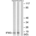 Western blot analysis of extracts from HepG2 cells and HeLa cells, using IFM3 antibody.