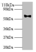 Western blot
All lanes: Major capsid protein L1 antibody at 2ug/ml + 293T whole cell lysate
Secondary
Goat polyclonal to rabbit IgG at 1/10000 dilution
Predicted band size: 62 kDa
Observed band size: 62 kDa