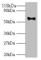 Western blot
All lanes: Major capsid protein L1 antibody at 2ug/ml + 293T whole cell lysate
Secondary
Goat polyclonal to rabbit IgG at 1/10000 dilution
Predicted band size: 62 kDa
Observed band size: 62 kDa