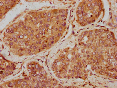 IGF1 Antibody – Figure 1 of 1