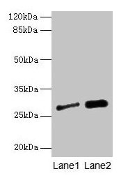 Western blot
All lanes: IGFBP1 antibody at 3µg/ml
Lane 1: A549 whole cell lysate
Lane 2: PC-3 whole cell lysate
Secondary
Goat polyclonal to rabbit IgG at 1/10000 dilution
Predicted band size: 28 kDa
Observed band size: 28 kDa