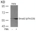 Western blot analysis of extracts from Hela cells untreated or treated with PMA using Smad2(Phospho-Thr220) Antibody.
