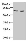 Western blot
All lanes: TNFRSF11A antibody at 2µg/ml
Lane 1: EC109 whole cell lysate
Lane 2: 293T whole cell lysate
Secondary
Goat polyclonal to rabbit IgG at 1/15000 dilution
Predicted band size: 67, 33, 37, 29, 57, 65 kDa
Observed band size: 67 kDa