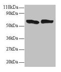 Western blot
All lanes: TNF antibody at 2µg/ml
Lane 1: 293T whole cell lysate
Lane 2: EC109 whole cell lysate
Secondary
Goat polyclonal to rabbit IgG at 1/15000 dilution
Predicted band size: 26 kDa
Observed band size: 60 kDa