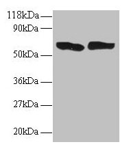 Western blot
All lanes: TNF antibody at 2µg/ml
Lane 1: 293T whole cell lysate
Lane 2: EC109 whole cell lysate
Secondary
Goat polyclonal to rabbit IgG at 1/15000 dilution
Predicted band size: 26 kDa
Observed band size: 60 kDa