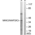 Western blot analysis of extracts from Jurkat cells, treated with serum (20%, 15mins), using MAP2K3 (Ab-222) antibody.