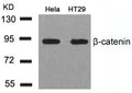 Western blot analysis of extracts from Hela and HT29 cells using b-Catenin(Ab-41/45) Antibody.