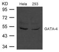 Western blot analysis of extract from Hela and 293 cells using GATA-4 Antibody