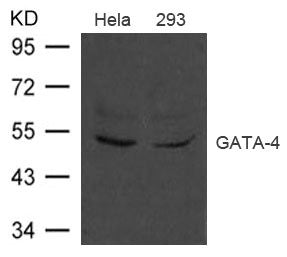 Western blot analysis of extract from Hela and 293 cells using GATA-4 Antibody