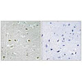 Immunohistochemistry analysis of paraffin-embedded human brain tissue using URB1 antibody.