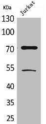 Western Blot analysis of Jurkat cells using Acetyl-Ku-70 (K539) Polyclonal Antibody