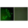 Immunofluorescence analysis of A549 cells, using p63 antibody.