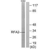 Western blot analysis of extracts from K562 cells, using RFA2 (Ab-21) antibody.