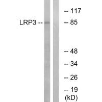 Western blot analysis of extracts from RAW264.7 cells, using LRP3 antibody.