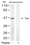 Western blot analysis of extracts from rat hippocampus tissue using Tau(Ab-422) Antibody and the same antibody preincubated with blocking peptide.