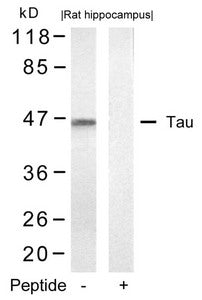 Western blot analysis of extracts from rat hippocampus tissue using Tau(Ab-422) Antibody and the same antibody preincubated with blocking peptide.