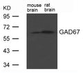 Western blot analysis of extract from Rat brain and Mouse brain Tissue using GAD67(GAD1) Antibody