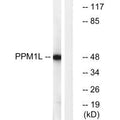 Western blot analysis of extracts from Jurkat cells, using PPM1L antibody.