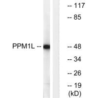 Western blot analysis of extracts from Jurkat cells, using PPM1L antibody.