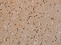 GADD45A Antibody – Figure 1 of 2