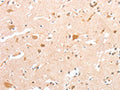 The image on the left is immunohistochemistry of paraffin-embedded Human brain tissue using CSB-PA087998(CIDEC Antibody) at dilution 1/30, on the right is treated with fusion protein. (Original magnification: ×200)