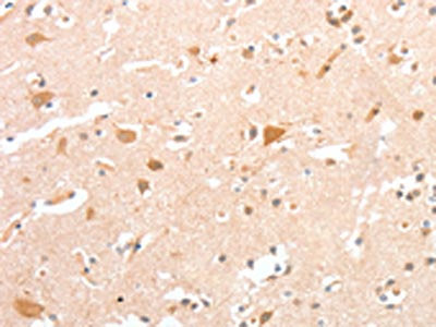 The image on the left is immunohistochemistry of paraffin-embedded Human brain tissue using CSB-PA087998(CIDEC Antibody) at dilution 1/30, on the right is treated with fusion protein. (Original magnification: ×200)
