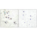 Immunohistochemical analysis of paraffin-embedded human brain tissue using Ezrin antibody.