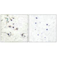 Immunohistochemical analysis of paraffin-embedded human brain tissue using Ezrin antibody.