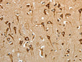 The image on the left is immunohistochemistry of paraffin-embedded Human brain tissue using CSB-PA088395(HSP90B1 Antibody) at dilution 1/50, on the right is treated with fusion protein. (Original magnification: ×200)
