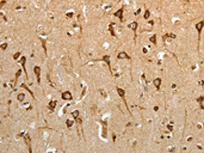 The image on the left is immunohistochemistry of paraffin-embedded Human brain tissue using CSB-PA088395(HSP90B1 Antibody) at dilution 1/50, on the right is treated with fusion protein. (Original magnification: ×200)